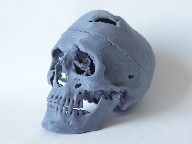 3D print of Phineas Gage's skull, which includes a hole in the front of the skull.