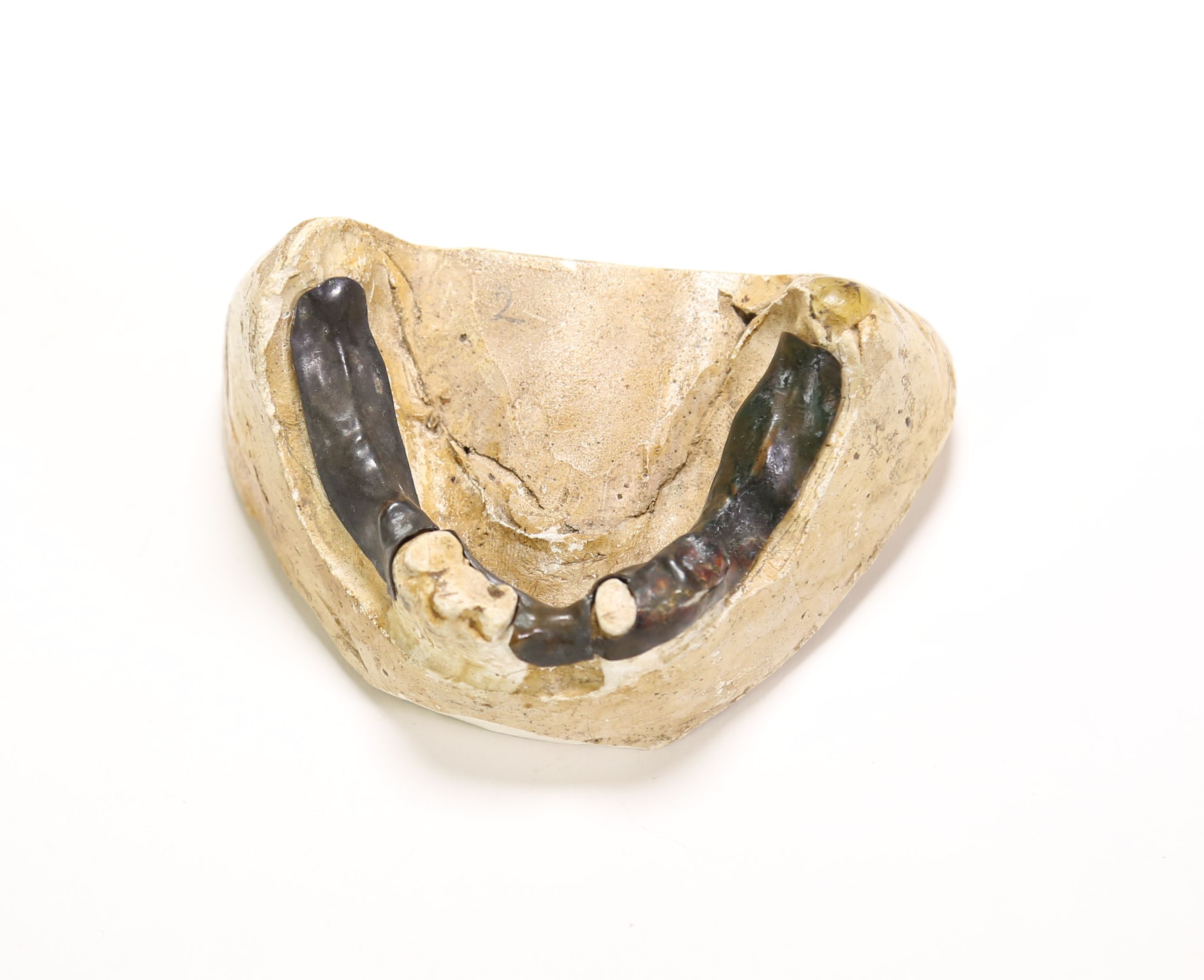 plaster dental cast